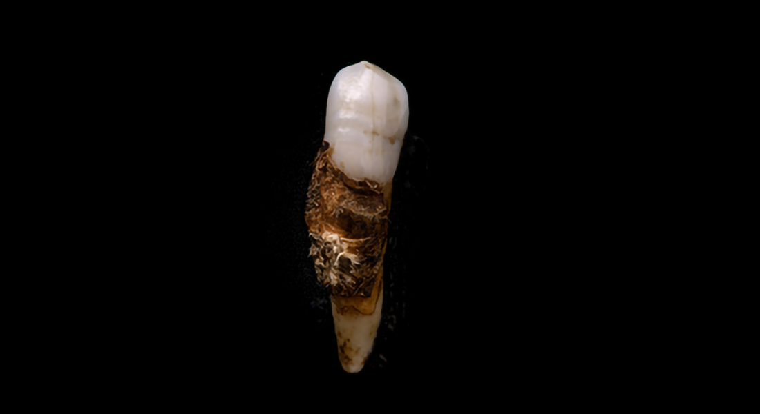 Human tooth on black background